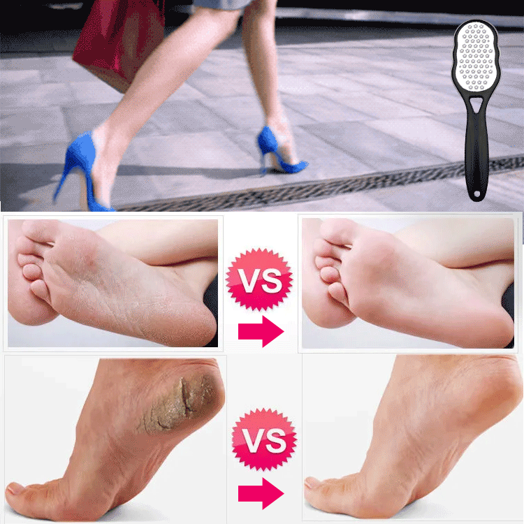 🔥New Year Promotion✨German Callus Removal Foot File
