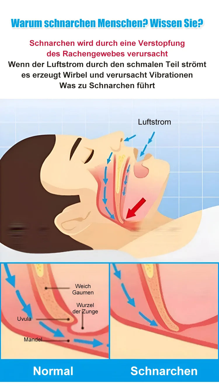 Magnetic anti-snoring device