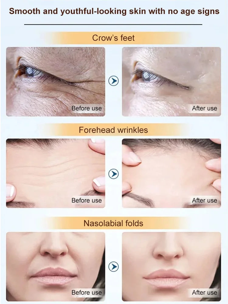 Facial Contouring Lift & Go Canister(3 PCS/SET)