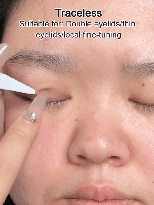 Localized Invisible Lace Double Eyelids
