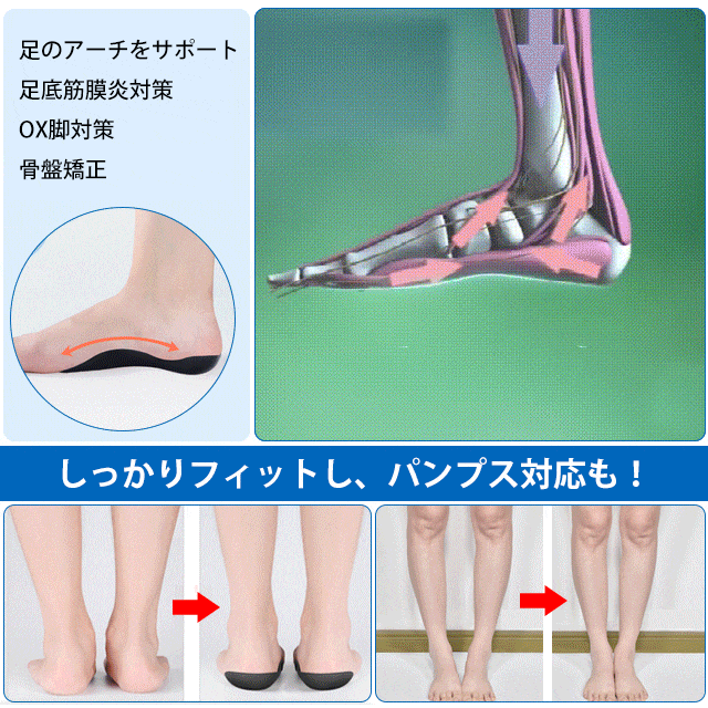 🔥Price Reduce Promotion! Flat Foot Correction Insoles