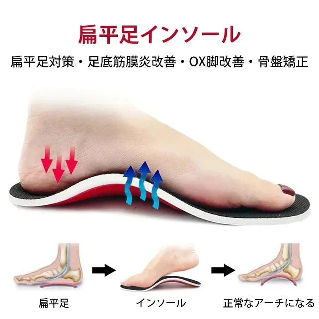 🔥Price Reduce Promotion! Flat Foot Correction Insoles