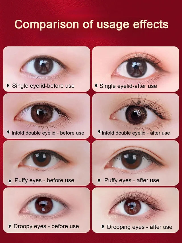 Localized Invisible Lace Double Eyelids