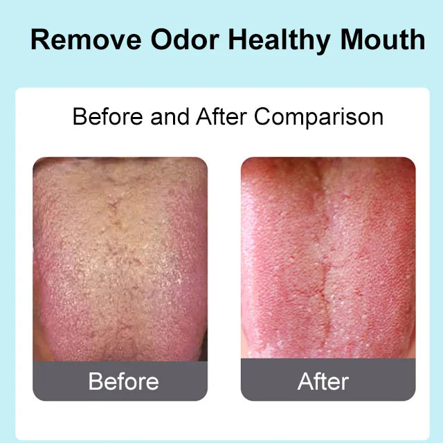 Stainless Steel Tongue Scrapers