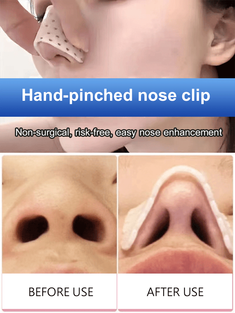 [Increase height and shape] Thermoplastic nose splint